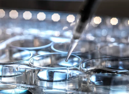 幹細胞治療新型肺炎費用高嗎?能報銷嗎? 幹細胞治療新型肺炎費用高嗎?能報銷嗎?