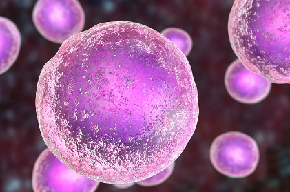 骨髓瘤幹細胞提取過程圖片解析,手術難度揭秘! 骨髓瘤幹細胞提取過程圖片解析,手術難度揭秘!