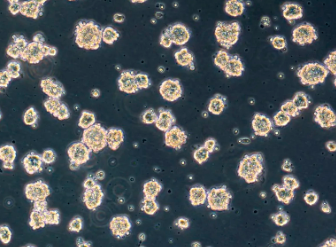 造血幹細胞移植哪家醫院好?如何提高移植成功率? 造血幹細胞移植哪家醫院好?如何提高移植成功率?