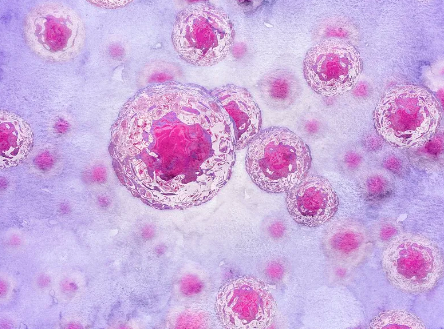 台州糖尿病幹細胞功效及治療實例分析。 台州糖尿病幹細胞功效及治療實例分析。