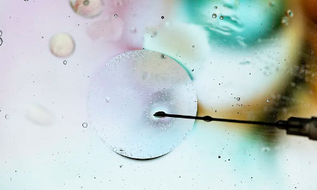 幹細胞治療癫痫病效果如何？有哪些成功案例？