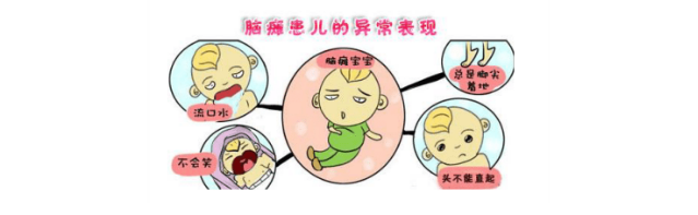 關于腦癱病因類型、診斷檢查、防治護理的完全手冊
