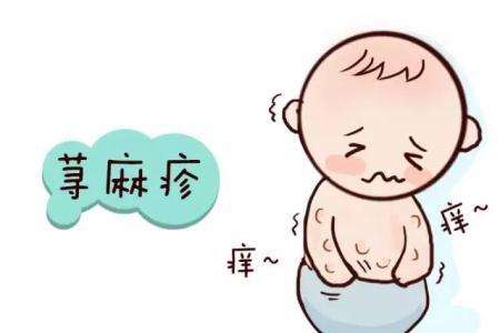 荨麻疹的檢查方法，重視起來遠離疾病！