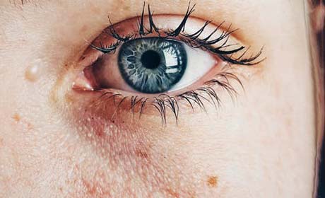 皮炎出現都有哪些症狀?怎樣治療皮炎?