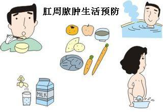 如何預防肛周膿腫?術後有哪些注意事項?