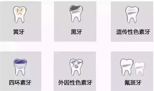 皓齒美白，讓你自然笑起來~了解一下吧