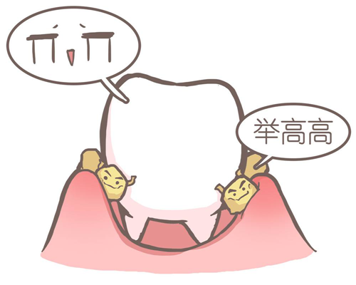 洗牙和牙周刮治有什麽區别？不都是清潔牙齒嗎？