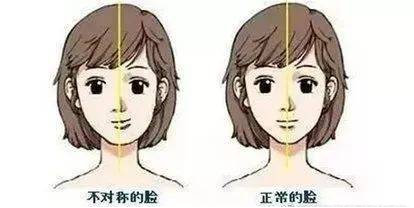 12歲前要處理的10種兒童牙颌畸形