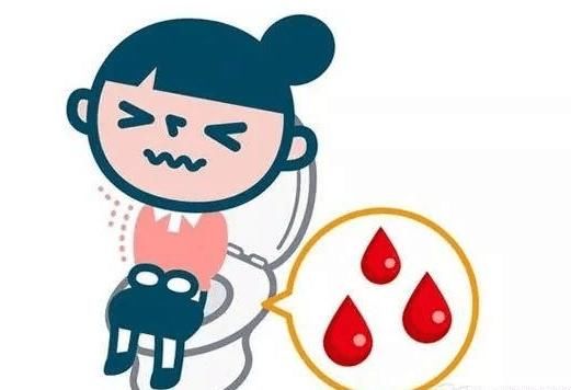 不要讓肛裂撕裂了生活!