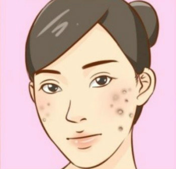 小心！化妝品有時候也會給我們帶來皮膚病