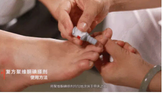 灰指甲引發骨髓炎嗎？灰指甲要如何治療？