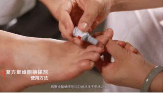 灰指甲視頻裏說是真的嗎？真有那麽可怕嗎？