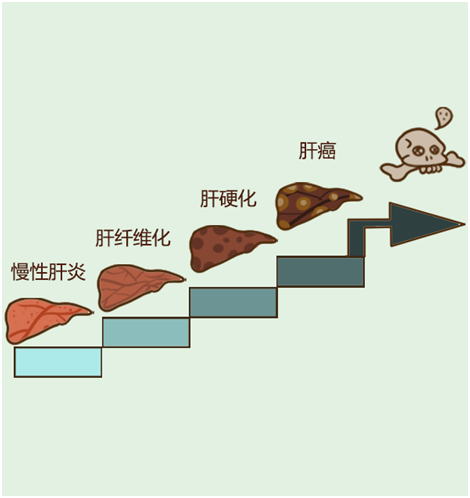 複方鼈甲軟肝片的主要功效是什麽？效果如何？