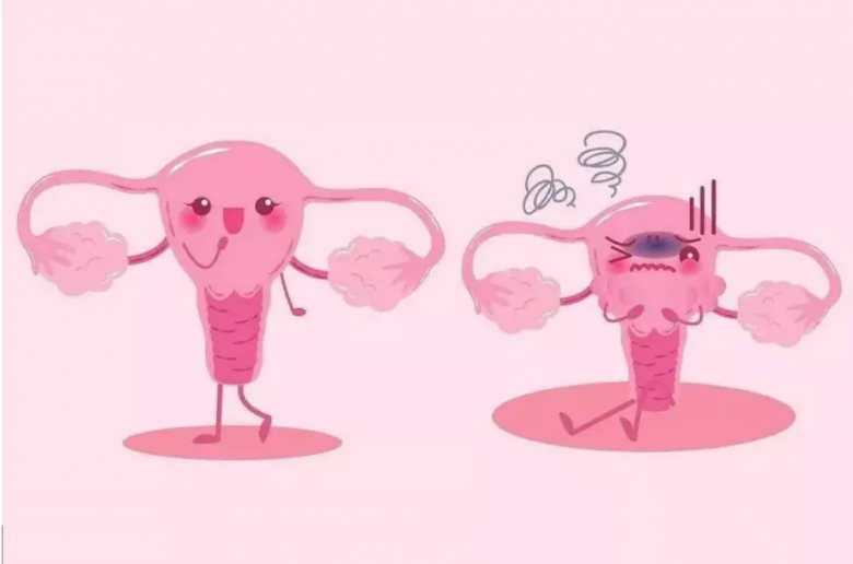 陰道感染總複發？原因是陰道微生态平衡被打破！