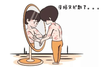上海可以治療銀屑病的醫院是哪家？