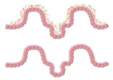 便秘吃什麽菜排便好？想要治本還需靠它！