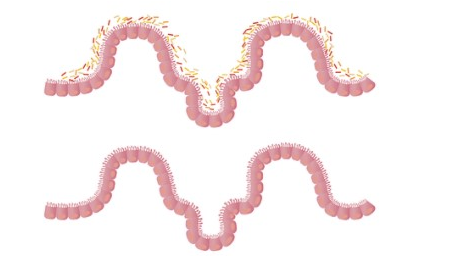 一入秋冬，腸道就愛出問題？總是便秘還容易拉肚子怎麽辦？