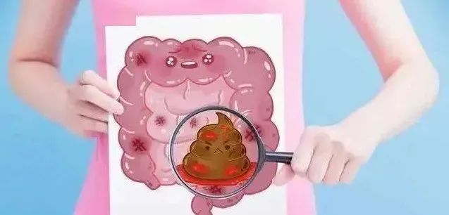 好好的就出現了便血？事情一定不簡單