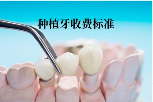 種植牙收費标準
