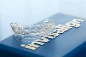 牙齒矯正多少錢價格表2023：一網打盡市面常見牙套收費!