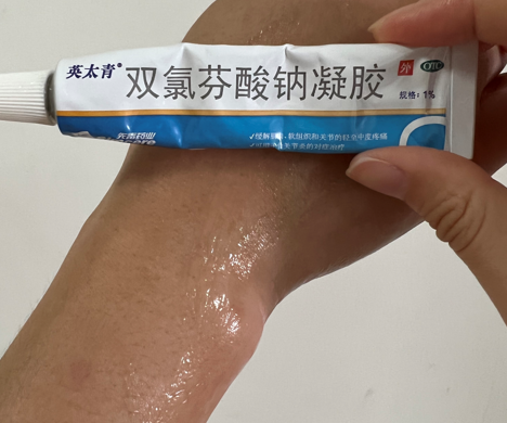 治療扭傷疼痛，芬必得和英太青凝膠哪一種好些？
