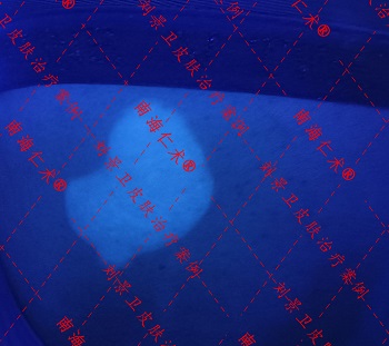 海南白癜風醫院新型不磨皮手術成爲白癜風治療特色