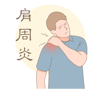 英太青治肩周炎好嗎？肩周炎患者做哪些鍛煉有幫助？