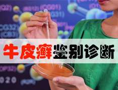 牛皮癬應該怎麽診斷