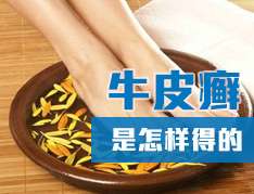 牛皮癬怎麽造成的