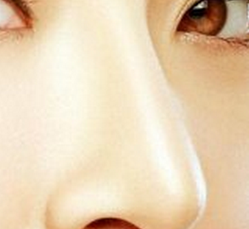 北京打玻尿酸隆鼻如何