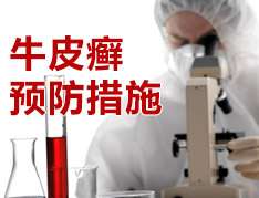 預防牛皮癬複發的方法有哪些