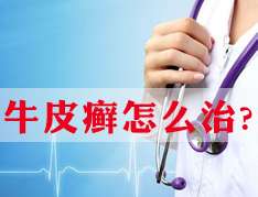 牛皮癬疾病的治療原則有什麽