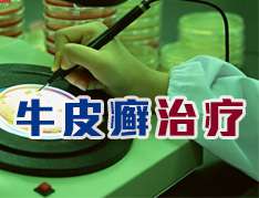 兒童牛皮癬的治療