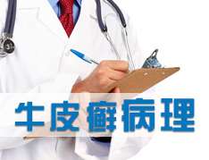 不同的病因牛皮癬有什麽不同