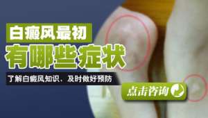 白癜瘋的初期症狀有哪些比較常見