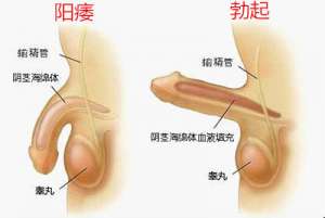 陽痿西醫治療方法有哪些
