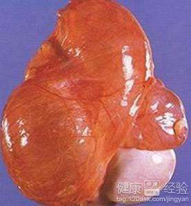 你知道到睾丸囊腫的病因嗎？