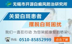 白癜風醫生袁仁軍詳談治好白癜風的藥膏