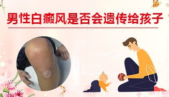 白癜風應該如何治療呢?白癜風醫院醫治白癜風怎麽樣