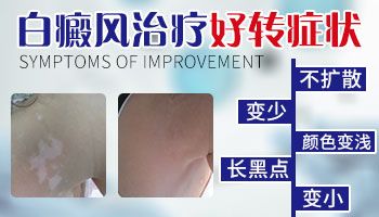 爲什麽白癜風長期治療無效?肇慶白癜風醫院治療白癜風效果