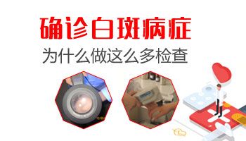 肇慶治療兒童白癜風有哪些新方法呢?