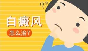 額頭白癜風如何治更好?