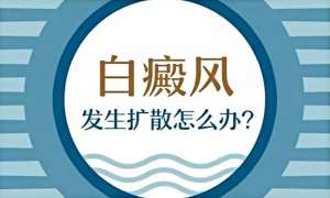 什麽情況會刺激穩定期白斑擴散?
