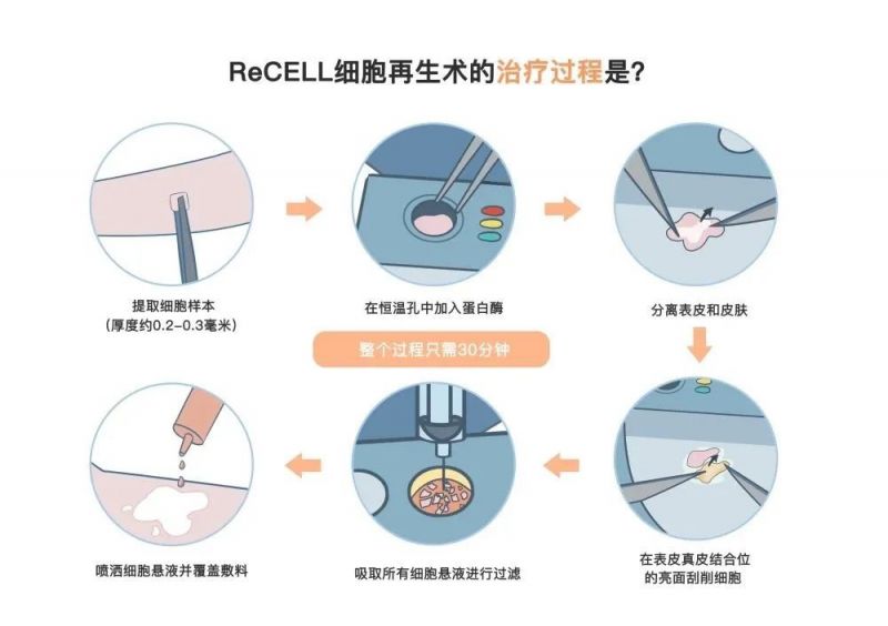 白癜風醫院鹽城哪家好排名榜公布，白斑又擴散了，夏季這些治療優勢你知道嗎？還不快來強化治療！