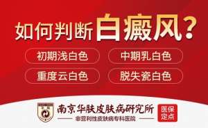 白癜風患者必看：端午出行防曬指南+24小時在線挂号服務