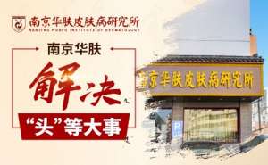 小兒斑秃是什麽原因引起的“南京治脫發斑秃醫院”