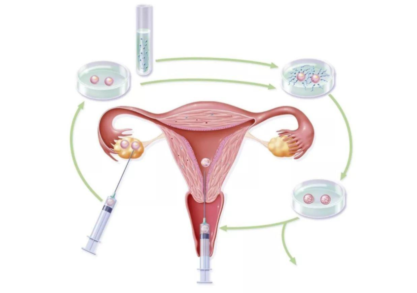 未婚去賀州做三代試管生孩子的的成功率高嗎？有50%嗎